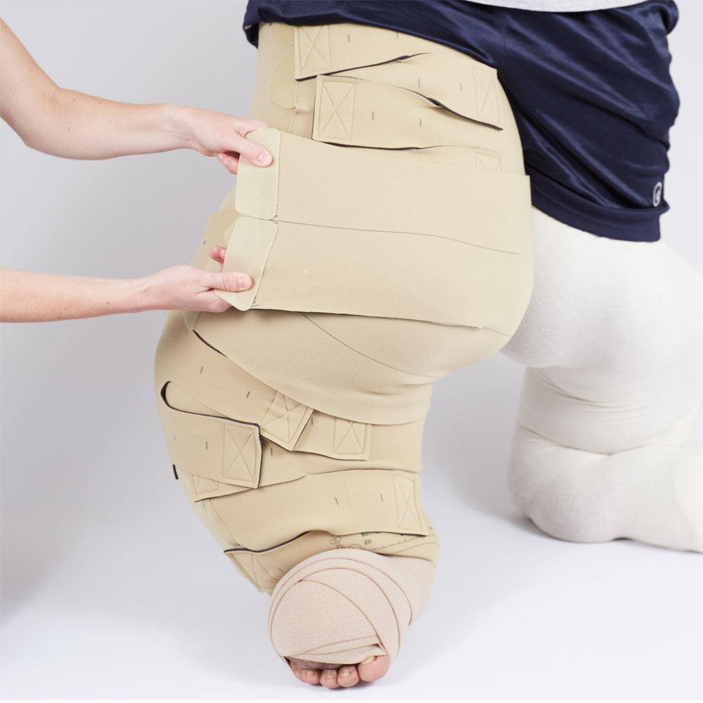 circaid reduction kit whole leg with lobe; lower leg short, upper leg short